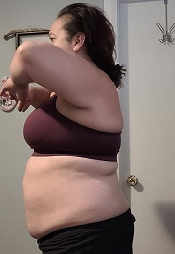 Client before photo
